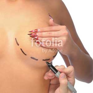 Breast Reduction